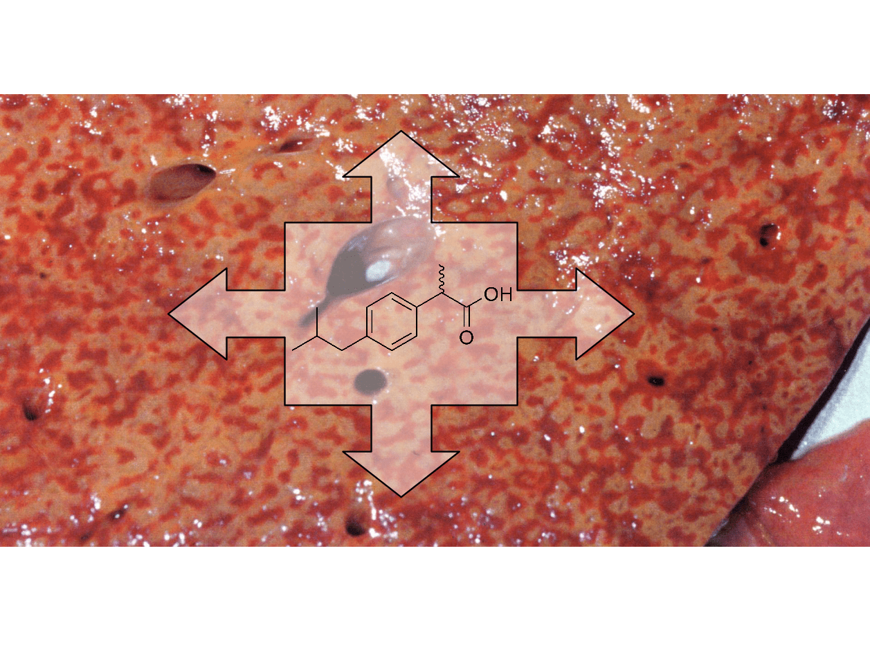 lesion-hepaticaxaines